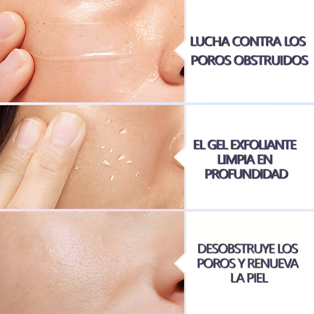 Gel Exfoliante QUARXERY 50gr- Paga 1 lleva 2